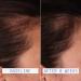 Shop AAVRANI Hair Density Boosting Scalp Serum for Thinning Hair & Hair Loss - 2 oz / 60 ml - 4 Month Supply Online - Best Price & International Shipping - Buy Online on GoSupps.com