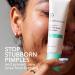 Shop Dr. Dennis Gross Skincare Alpha Beta On The Spot Eliminator 2% Salicylic Acid Acne Treatment Gel - 1 oz / 30 ml Online - Best Price & International Shipping - Buy Online on GoSupps.com