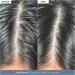 Shop Briogeo Scalp Revival Scalp Care Essentials Kit Online - Best Price & International Shipping - Buy Online on GoSupps.com