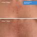 Shop Murad Retexturizing Body Pads with Salicylic Acid - 45 pads / pack Online - Best Price & International Shipping - Buy Online on GoSupps.com