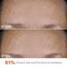 Shop Dr. Dennis Gross Skincare DermInfusions Blur + Repair Cream with Hyaluronic Acid and Peptides - 1.7 oz / 50 ml Online - Best Price & International Shipping - Buy Online on GoSupps.com
