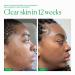 Shop The Nue Co. Barrier Clear Blemish Treatment - 1 oz / 30 ml Online - Best Price & International Shipping - Buy Online on GoSupps.com