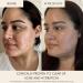 Shop MARA Niacinamide + Copper Clear Skin Mineral Milk Acne Treatment - 30mL - 1 oz / 30 mL Online - Best Price & International Shipping - Buy Online on GoSupps.com
