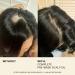Shop JVN Complete Pre-Wash Scalp & Hair Strengthening Treatment Oil - 1.7 oz/ 50 ml Online - Best Price & International Shipping - Buy Online on GoSupps.com