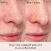 Shop Alpyn Beauty Clarifying Facial Oil with Retinol & Pink Algae - 1 oz / 30 ml Online - Best Price & International Shipping - Buy Online on GoSupps.com