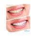 smileshop Teeth Whitening Kit - Buy Online on GoSupps.com