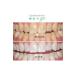 Opalescence Ultradent Go 20-Pack Mint Pre-Packed Teeth Whitening - Buy Online on GoSupps.com