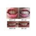 GELLO 2-Pack Teeth Whitening Gel (2 Pieces) - Buy Online on GoSupps.com