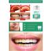 Xolo 5 Days Professional Teeth Whitening Effective Oral Care Teeth Whitening Powder - Buy Online on GoSupps.com
