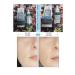 KOREACO PORE TIGHTENING REVITALIZING AND MOISTURIZING SERUM 50 ML....AHA-BHA%2 - Buy Online on GoSupps.com