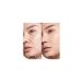 Dior Forever Skin Correct Full-Coverage 24-Hour Moisturizing Anti-Redness Anti-Blemish Concealer 11ML - Buy Online on GoSupps.com