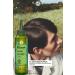 Yves Rocher Anti-Dandruff (Anti-Pelliculaire) Soothing Prebiotic Hair Care Lotion - Vegan-150 Ml - Buy Online on GoSupps.com