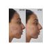 THE INKEY LIST Scar mark and wrinkle solution with 1% retinol - Face Serum 30 ml - Buy Online on GoSupps.com