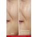 L'Oreal Paris Revitalift 5% Pure Glycolic Acid Peeling Tonic & Revitalift Filler Eye Serum - Buy Online on GoSupps.com