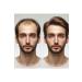 Organic 50 Gram Hair Thickening Topical. 99% Herbal Content. New Generation Mineral Fiber Feature - Buy Online on GoSupps.com