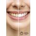 Dr Wrap Teeth Cleaning and Whitening Gel (10ML) - Buy Online on GoSupps.com