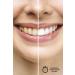 Lianore Teeth Cleaning and Whitening Gel (10ml) - Buy Online on GoSupps.com