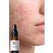 roc rochers Pore Tightening Complex Serum & Vitamin C + Niacinamide + Lactobionic Acid + Hyaluronic Acid