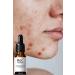 roc rochers Pore Tightening Complex Serum & Vitamin C + Niacinamide + Lactobionic Acid + Hyaluronic Acid - Buy Online on GoSupps.com