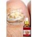 Puredermine Nail Fungus Deep Treatment Essence & Herbal Formula & Hand & Foot Treatment - Buy Online on GoSupps.com