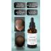 gouttes Anti-Loss New Hair Formation Supporting Hair Serum
