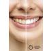 Missey Natural Teeth Whitening Gel Instant Whitening Effective Teeth Whitening Gel - Buy Online on GoSupps.com