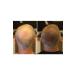 FIXPLANT 1 Bottle 28 gr Hair Thickening Powder - Dark Brown - Buy Online on GoSupps.com