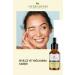 Herbaderm Super Serum Beta Solution (SALICYLIC ACID 2%) Anti-Acne 30 ml X2 - Buy Online on GoSupps.com