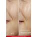 L'Oreal Paris Original New Product Revitalift Pure Glycolic Acid Peeling Tonic 180ml - Buy Online on GoSupps.com