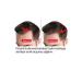 Purexpose Hair Care Serum - Hair Growth Helper Hair Formation Visualizer Extender 4 Pieces Dermaroller - Buy Online on GoSupps.com