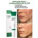 VEZE Facial cream from acne and acne with salicylic acid