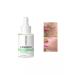 LANBENA From acne whey for sensitive skin 30 ml