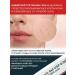 OsmMak Tretinoin gel 0.05% of acne and black points for USP - Buy Online on GoSupps.com