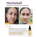 Lefami Serum for aligning the skin tone and post -acne - Buy Online on GoSupps.com