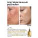 KEYCLEAR Serum vitamin C and peptides against pigmentation and post -acne - Buy Online on GoSupps.com