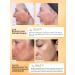 Lefami Wedeously for the face from post -acne and acne with niacinamide - Buy Online on GoSupps.com