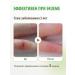 Acrustal Psoriasis ointment healing cream - Buy Online on GoSupps.com