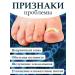 Chistomycon Nail fungus cream - Buy Online on GoSupps.com