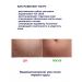 BREYLEE From stretch marks and scars for the body after childbirth - Buy Online on GoSupps.com