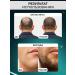 DRS Mesoroller for hair beards and faces 1mm - Buy Online on GoSupps.com