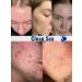Clean Sea Crust serum for acne and antennas - Buy Online on GoSupps.com