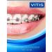 VITIS Set of orthodontic toothpaste 100 ml - Buy Online on GoSupps.com