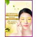 ASIANCOSMO Eye patches are tissue moisturizers with Ottomantus 80 pcs - Buy Online on GoSupps.com