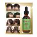 Mielle Rosemary oil for hair growth - Buy Online on GoSupps.com