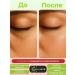 McLureSun Liquid eye patches from edema and bags - Buy Online on GoSupps.com