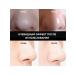 Eelhoe nasal mask for removing acne - Buy Online on GoSupps.com