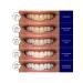 Eelhoe dazzling white dental veneers - Buy Online on GoSupps.com