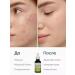 Facial serum from acne and black points of comedones acne - Buy Online on GoSupps.com