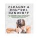 Avalon Organics Shampoo against dandruff with chamomile pharmacy - Buy Online on GoSupps.com