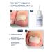INKI Softener for the treatment of ingrown nails on the legs and arms 100 - Buy Online on GoSupps.com